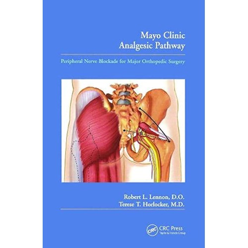 Mayo Clinic Analgesic Pathway: Peripheral Ner...