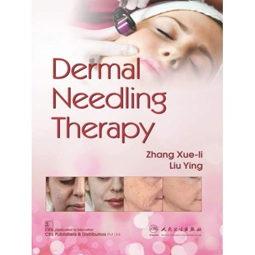 Dermal Needling Therapy (Pb 2019) 