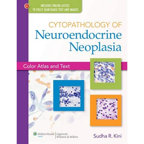 Cytopathology Of Neuroendocrine Neoplasia (Hb...