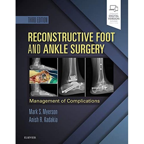 Reconstructive Foot And Ankle Surgery Managem...