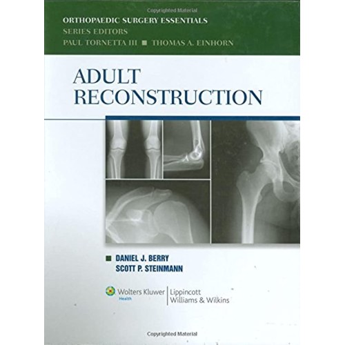 Orthopaedic Surgery Essentials Adult Reconstr...