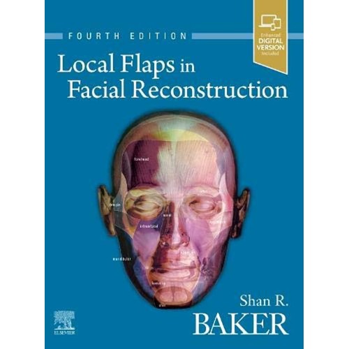 Local Flaps In Facial Reconstruction 4Ed (Hb ...