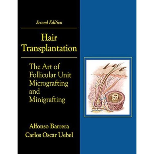 Hair Transplantation The Art Of Follicular Un...