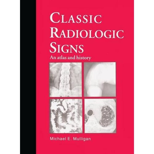 Classic Radiologic Signs: An Atlas And Histor...