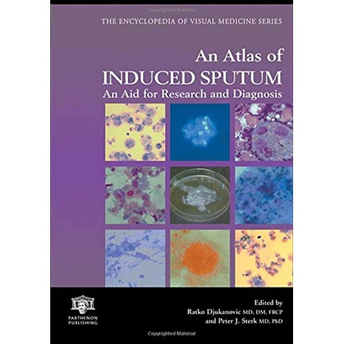 Atlas Of Induced Sputum 