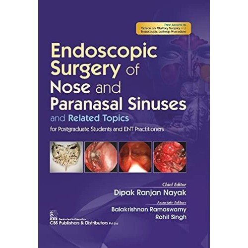 Endoscopic Surgery Of Nose And Paranasal Sinu...