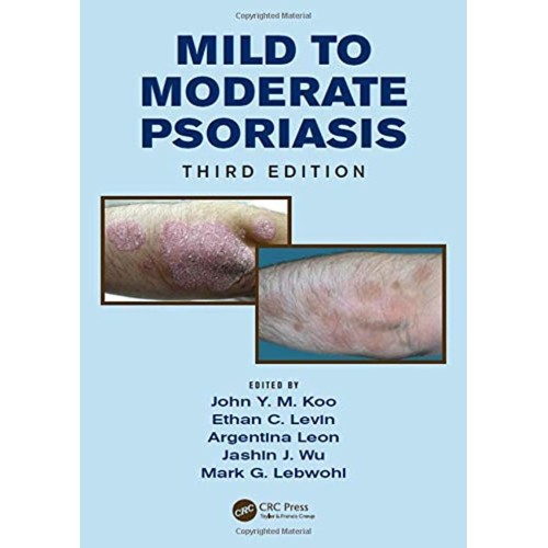 Mild To Moderate Psoriasis 3Ed (Hb 2014) 