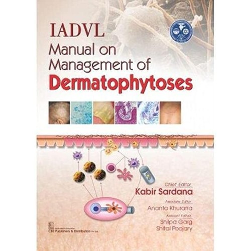 Iadvl Manual On Management Of Dermatophytoses...