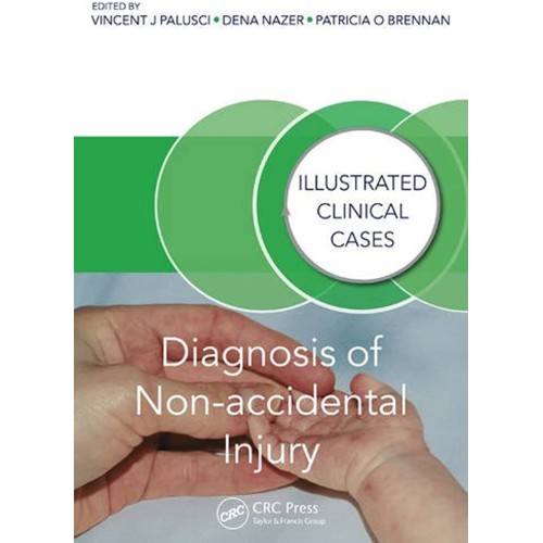 Diagnosis Of Non Accidental Injury Illustrate...