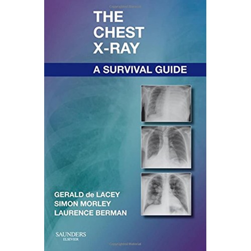 The Chest X Ray A Survival Guide (Pb 2008) 