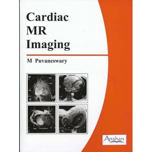 Cardiac Mr Imaging 