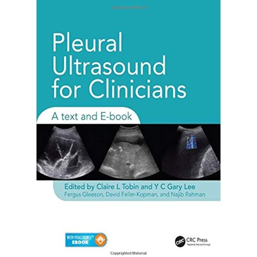 Pleural Ultrasound For Clinicians A Text And ...