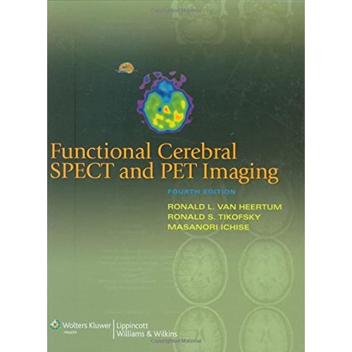 Functional Cerebral Spect & Pet Imaging, 4E (...