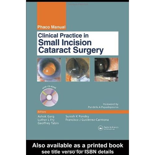 Clinical Practice In Small Incision Cataract ...