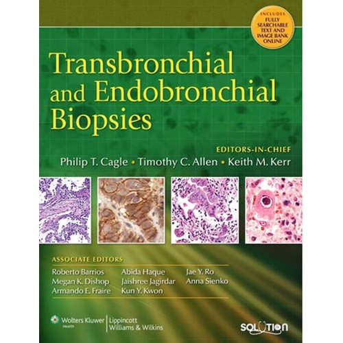 Transbronchial And Endobronchial Biopsies 200...