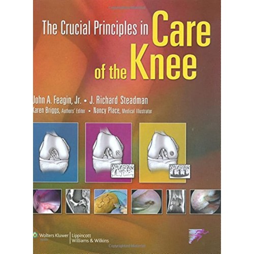 The Crucial Principles In Care Of The Knee 20...