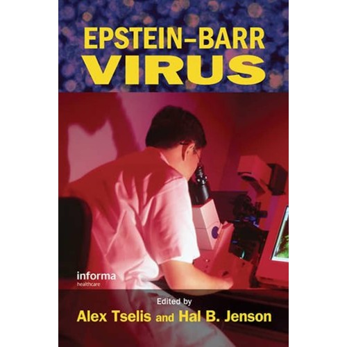 Epstein-Barr Virus 