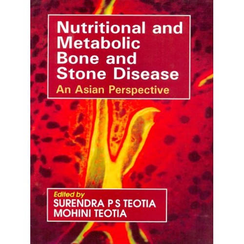 Nutritional And Metabolic Bone And Stone Dise...