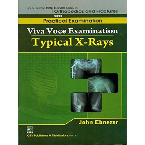 Typical X Rays (Handbooks In Orthopedics And ...