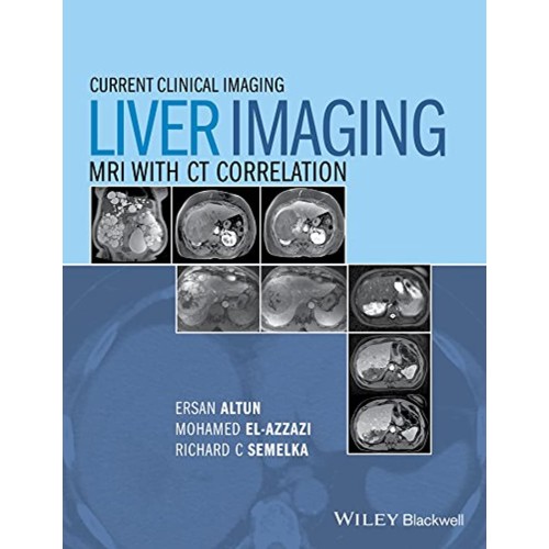 Current Clinical Imaging Liver Imaging Mri Wi...