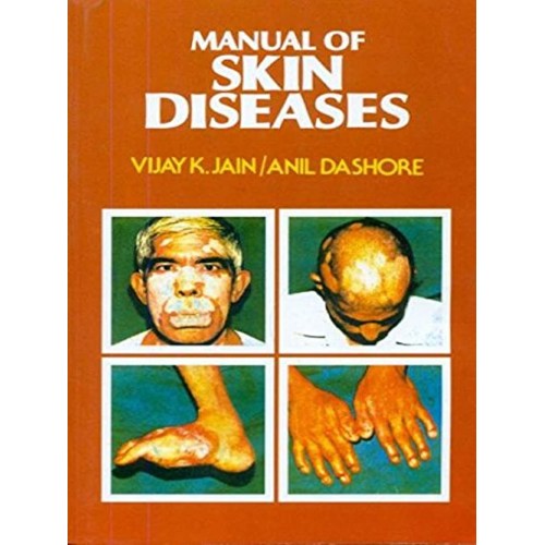 Manual Of Skin Diseases (Pb 2018) 