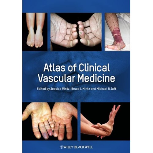 Atlas Of Clinical Vascular Medicine (Hb 2013)...