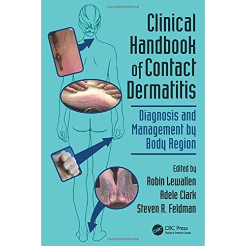 Clinical Handbook Of Contact Dermatitis (Pb 2...