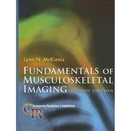 Fundamentals Of Musculoskeletal Imaging, 2/E 