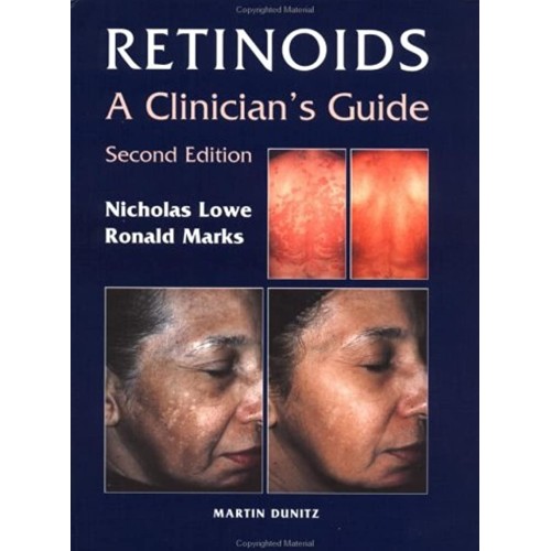 Retinoids: A Clinician'S Guide 