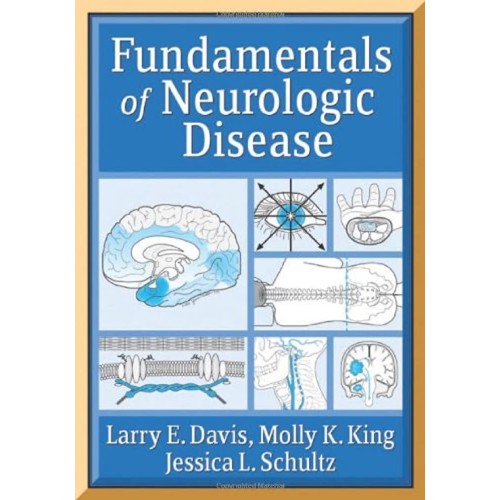 Fundamentals Of Neurologic Disease (Pb 2005) 