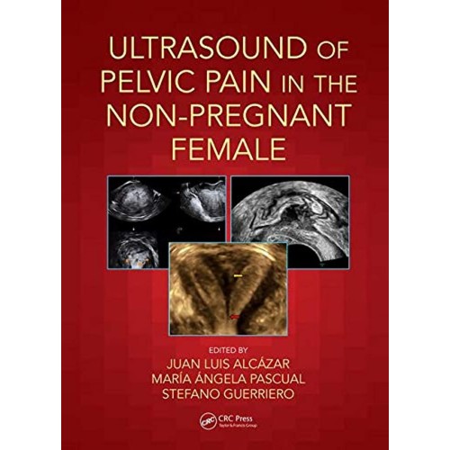 Ultrasound Of Pelvic Pain In The Non Pregnant...