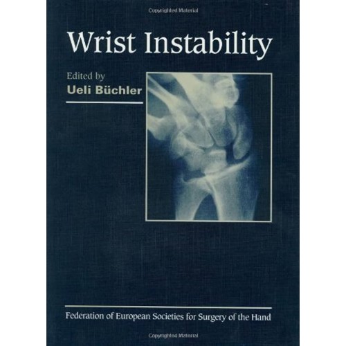 Wrist Instability 