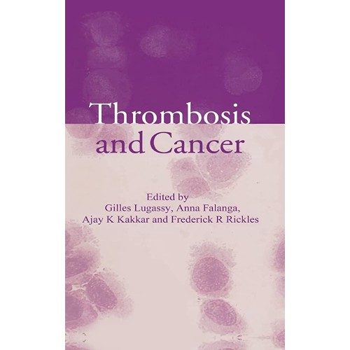 Thrombosis And Cancer 