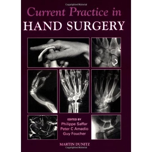 Hand Surgery: Current Practice 