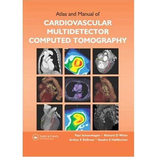 Atlas And Manual Of Cardiovascular Multidetec...