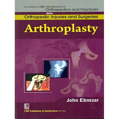 Arthroplasty (Handbooks In Orthopedics And Fr...