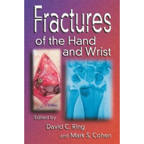 Fractures Of The Hand And Wrist 