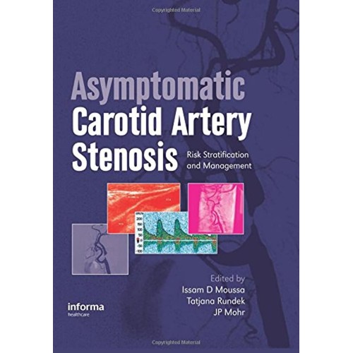 Asymptomatic Carotid Artery Stenosis Risk Str...