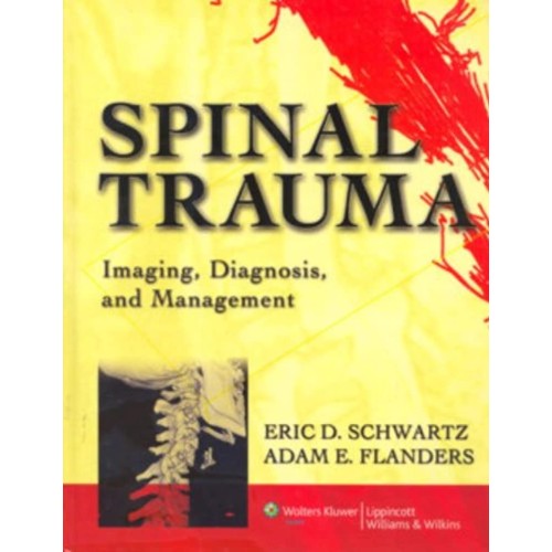 Spinal Trauma Imaging Diagnosis And Managemen...