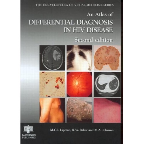 Atlas Diff Diag In Hiv Dis 2E 