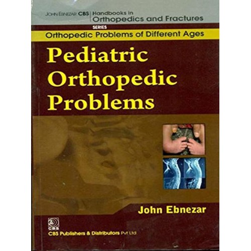 Pediatric Orthopedic Problems (Handbooks In O...