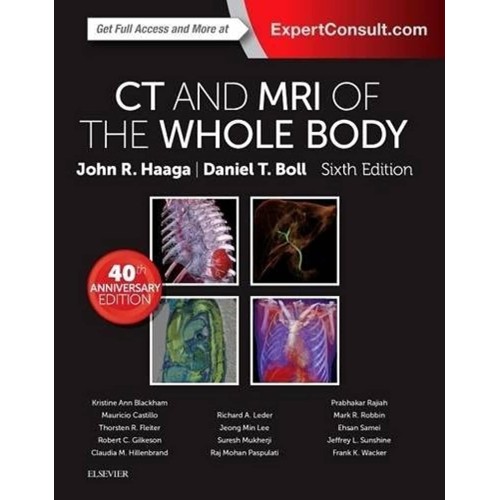 Ct And Mri Of The Whole Body 2 Vol Set 6Ed (H...