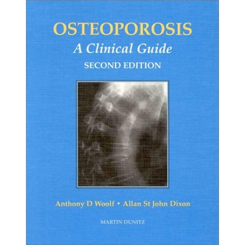 Osteoporosis: A Clinical Guide 2/E 