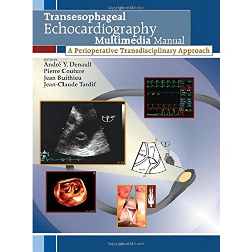 Transesophageal Echocardiography- Multimedia ...