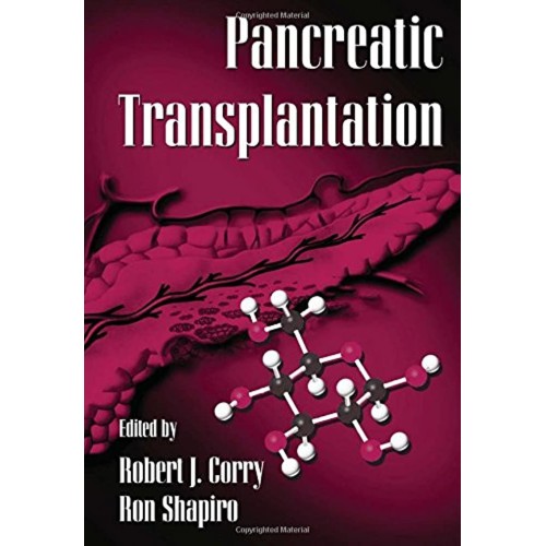 Pancreatic Transplantation 