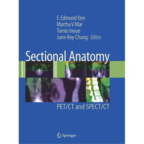 Sectional Anatomy: Pet/Ct And Spect/Ct 