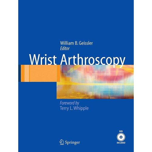 Wrist Arthroscopy 