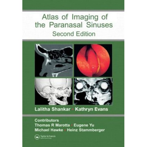 An Atlas Of Imaging Of The Paranasal Sinuses ...