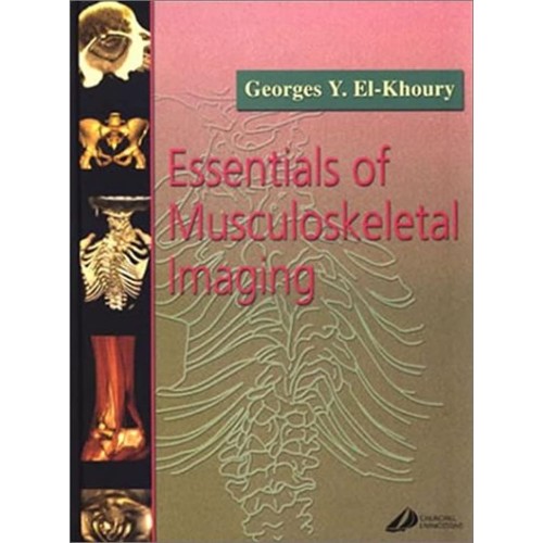 Essentials Of Musculoskeletal Imaging (Hb 200...