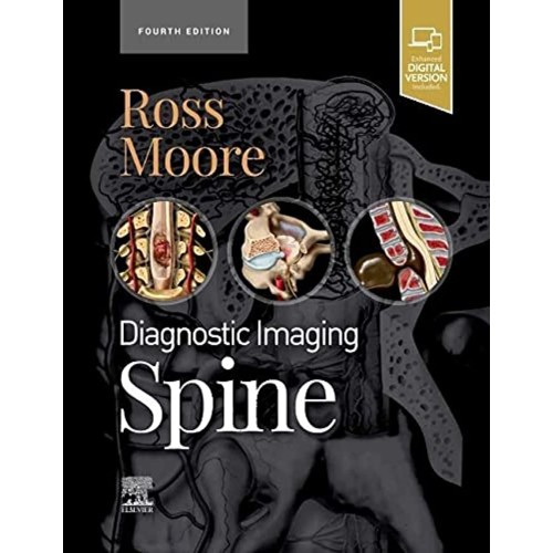 Diagnostic Imaging Spine With Access Code 4Ed...